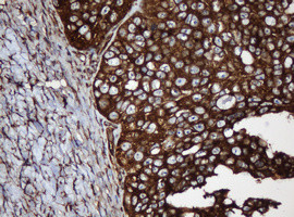 SERBP1 Antibody in Immunohistochemistry (Paraffin) (IHC (P))