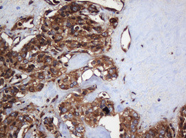 SERBP1 Antibody in Immunohistochemistry (Paraffin) (IHC (P))