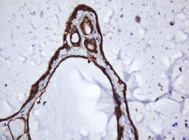 SERBP1 Antibody in Immunohistochemistry (Paraffin) (IHC (P))