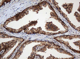 SERBP1 Antibody in Immunohistochemistry (Paraffin) (IHC (P))