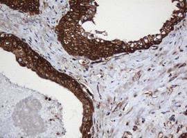 SERBP1 Antibody in Immunohistochemistry (Paraffin) (IHC (P))