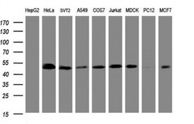 SERBP1 Antibody in Western Blot (WB)