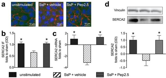 SERCA2 ATPase Antibody in Western Blot, Immunocytochemistry (WB, ICC/IF)