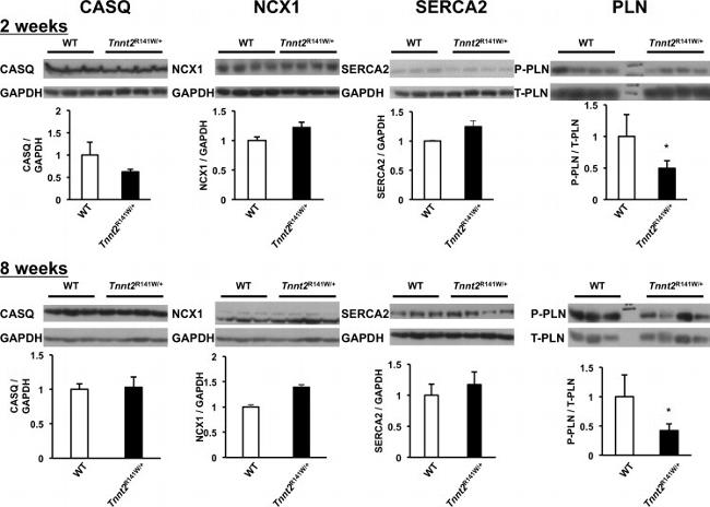 SERCA2 ATPase Antibody in Western Blot (WB)