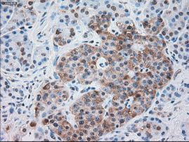 SERPINA1 Antibody in Immunohistochemistry (Paraffin) (IHC (P))