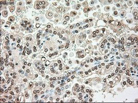 SERPINA1 Antibody in Immunohistochemistry (Paraffin) (IHC (P))