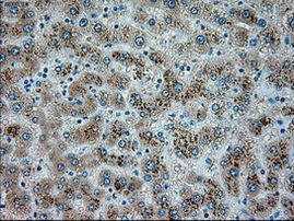 SERPINA1 Antibody in Immunohistochemistry (Paraffin) (IHC (P))