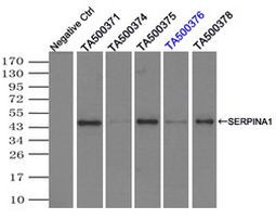 SERPINA1 Antibody in Immunoprecipitation (IP)