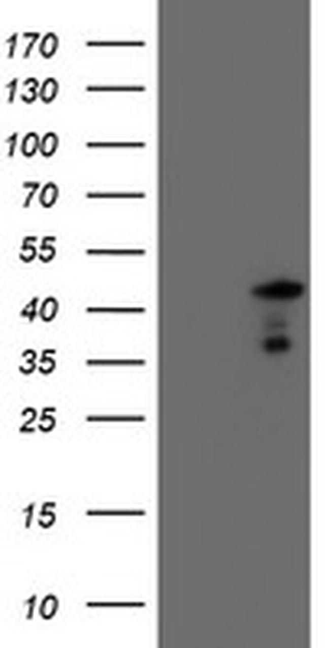 SERPINA5 Antibody in Western Blot (WB)