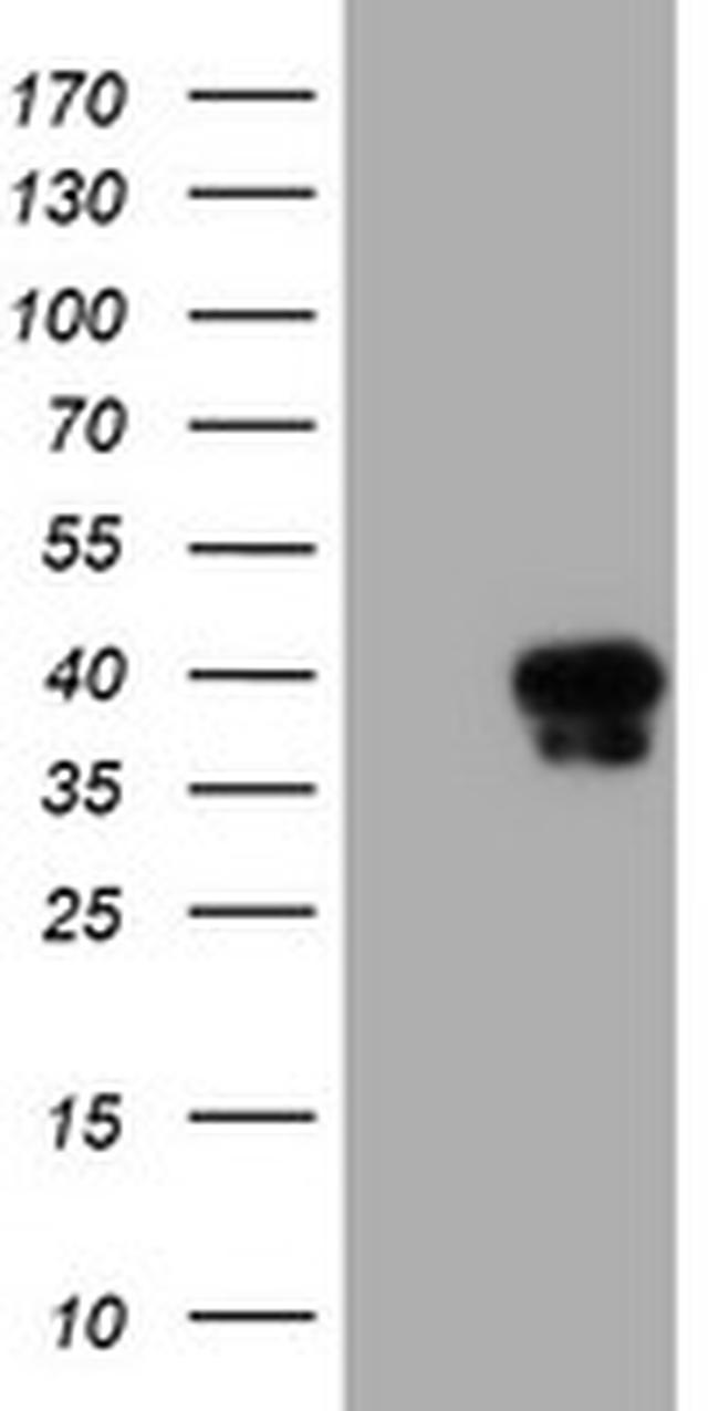 SERPINA5 Antibody in Western Blot (WB)