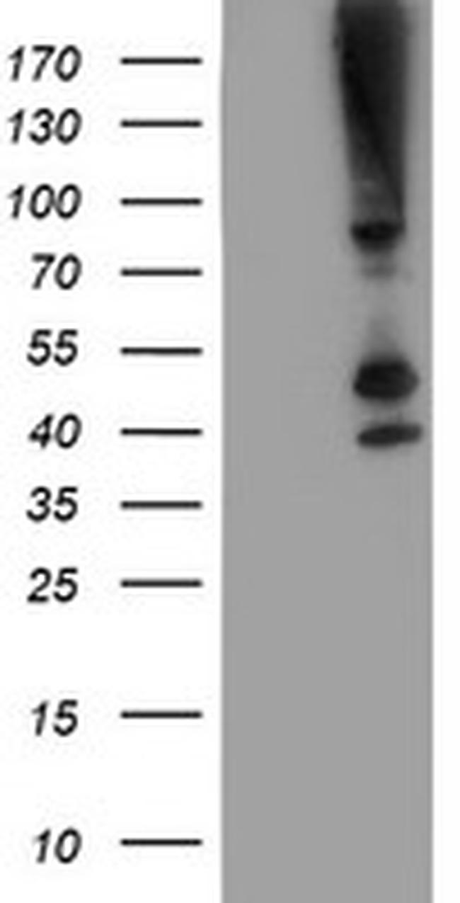 SERPINB13 Antibody in Western Blot (WB)