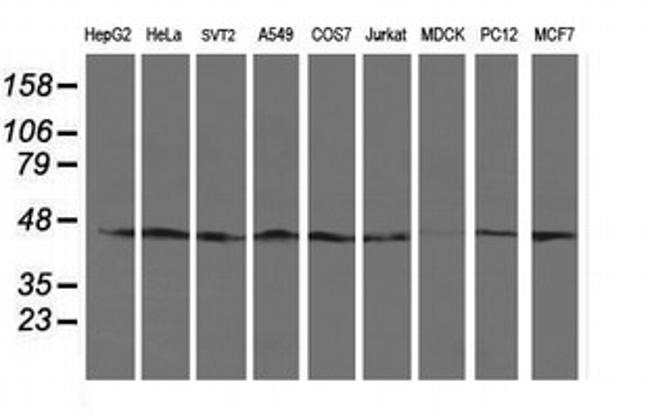 SERPINB13 Antibody in Western Blot (WB)