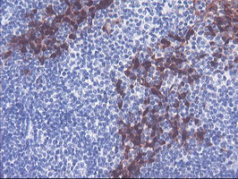 SERPINB2 Antibody in Immunohistochemistry (Paraffin) (IHC (P))