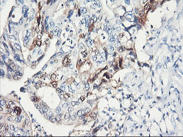 SERPINB2 Antibody in Immunohistochemistry (Paraffin) (IHC (P))