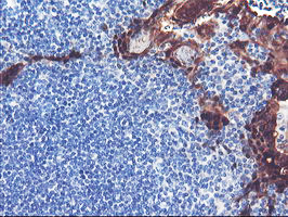 SERPINB2 Antibody in Immunohistochemistry (Paraffin) (IHC (P))