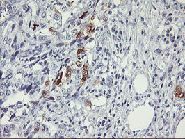 SERPINB2 Antibody in Immunohistochemistry (Paraffin) (IHC (P))