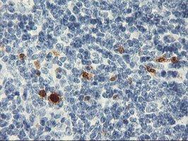 SERPINB2 Antibody in Immunohistochemistry (Paraffin) (IHC (P))