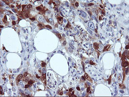 SERPINB2 Antibody in Immunohistochemistry (Paraffin) (IHC (P))