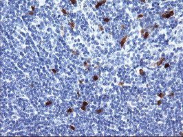 SERPINB2 Antibody in Immunohistochemistry (Paraffin) (IHC (P))