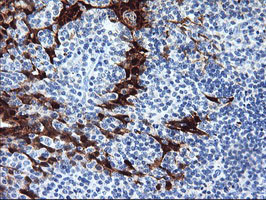 SERPINB2 Antibody in Immunohistochemistry (Paraffin) (IHC (P))