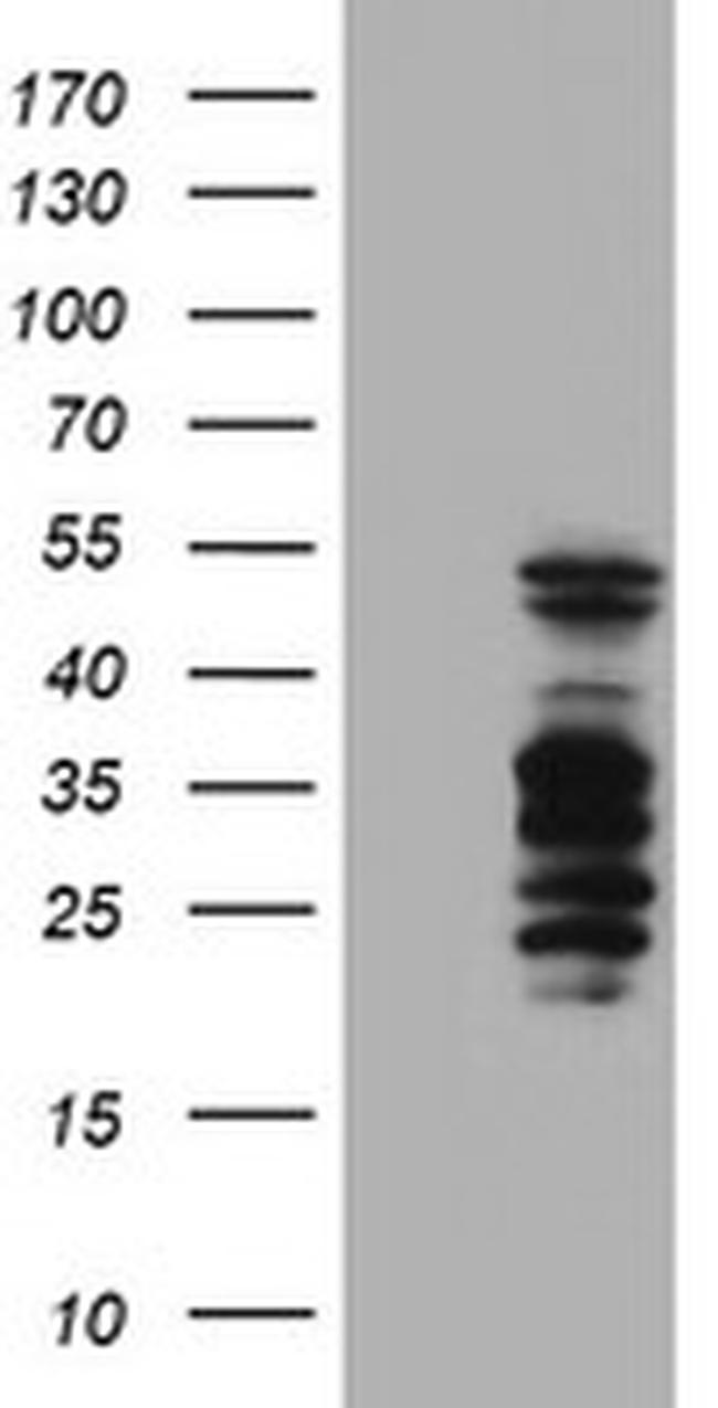 SERPINB2 Antibody in Western Blot (WB)