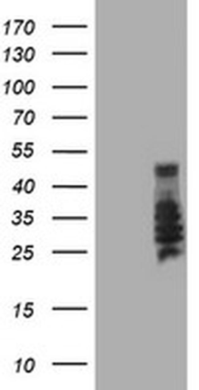 SERPINB2 Antibody in Western Blot (WB)