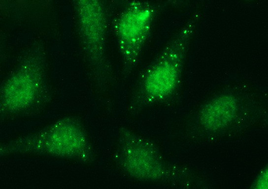 SERPINB3 Antibody in Immunocytochemistry (ICC/IF)