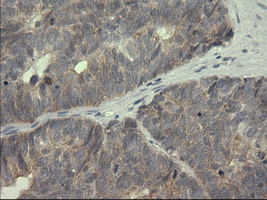 SERPINB3 Antibody in Immunohistochemistry (Paraffin) (IHC (P))