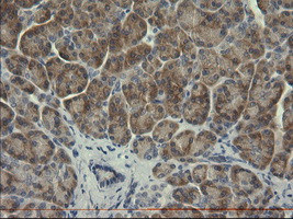 SERPINB3 Antibody in Immunohistochemistry (Paraffin) (IHC (P))