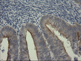 SERPINB3 Antibody in Immunohistochemistry (Paraffin) (IHC (P))