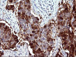 SERPINB3 Antibody in Immunohistochemistry (Paraffin) (IHC (P))