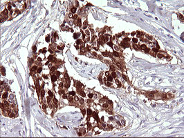 SERPINB3 Antibody in Immunohistochemistry (Paraffin) (IHC (P))