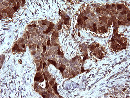 SERPINB3 Antibody in Immunohistochemistry (Paraffin) (IHC (P))