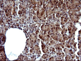 SERPINB3 Antibody in Immunohistochemistry (Paraffin) (IHC (P))