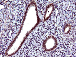 SERPINB3 Antibody in Immunohistochemistry (Paraffin) (IHC (P))