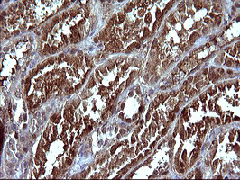 SERPINB3 Antibody in Immunohistochemistry (Paraffin) (IHC (P))