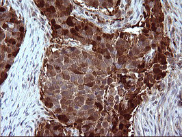 SERPINB3 Antibody in Immunohistochemistry (Paraffin) (IHC (P))