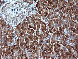 SERPINB3 Antibody in Immunohistochemistry (Paraffin) (IHC (P))