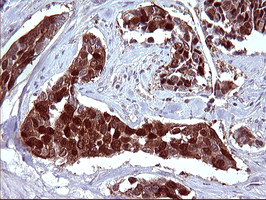 SERPINB3 Antibody in Immunohistochemistry (Paraffin) (IHC (P))