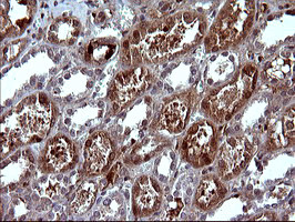 SERPINB3 Antibody in Immunohistochemistry (Paraffin) (IHC (P))