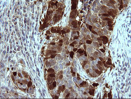 SERPINB3 Antibody in Immunohistochemistry (Paraffin) (IHC (P))