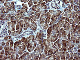 SERPINB3 Antibody in Immunohistochemistry (Paraffin) (IHC (P))