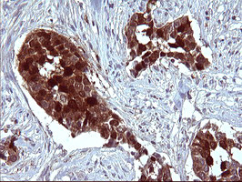 SERPINB3 Antibody in Immunohistochemistry (Paraffin) (IHC (P))