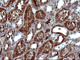 SERPINB3 Antibody in Immunohistochemistry (Paraffin) (IHC (P))