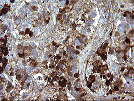 SERPINB3 Antibody in Immunohistochemistry (Paraffin) (IHC (P))