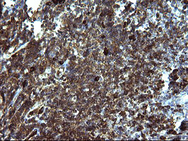 SERPINB3 Antibody in Immunohistochemistry (Paraffin) (IHC (P))