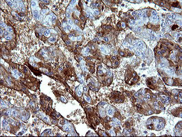 SERPINB3 Antibody in Immunohistochemistry (Paraffin) (IHC (P))