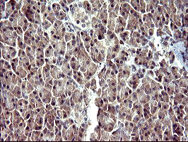 SERPINB3 Antibody in Immunohistochemistry (Paraffin) (IHC (P))