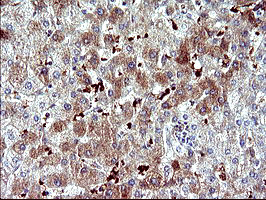 SERPINB3 Antibody in Immunohistochemistry (Paraffin) (IHC (P))