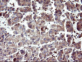 SERPINB3 Antibody in Immunohistochemistry (Paraffin) (IHC (P))